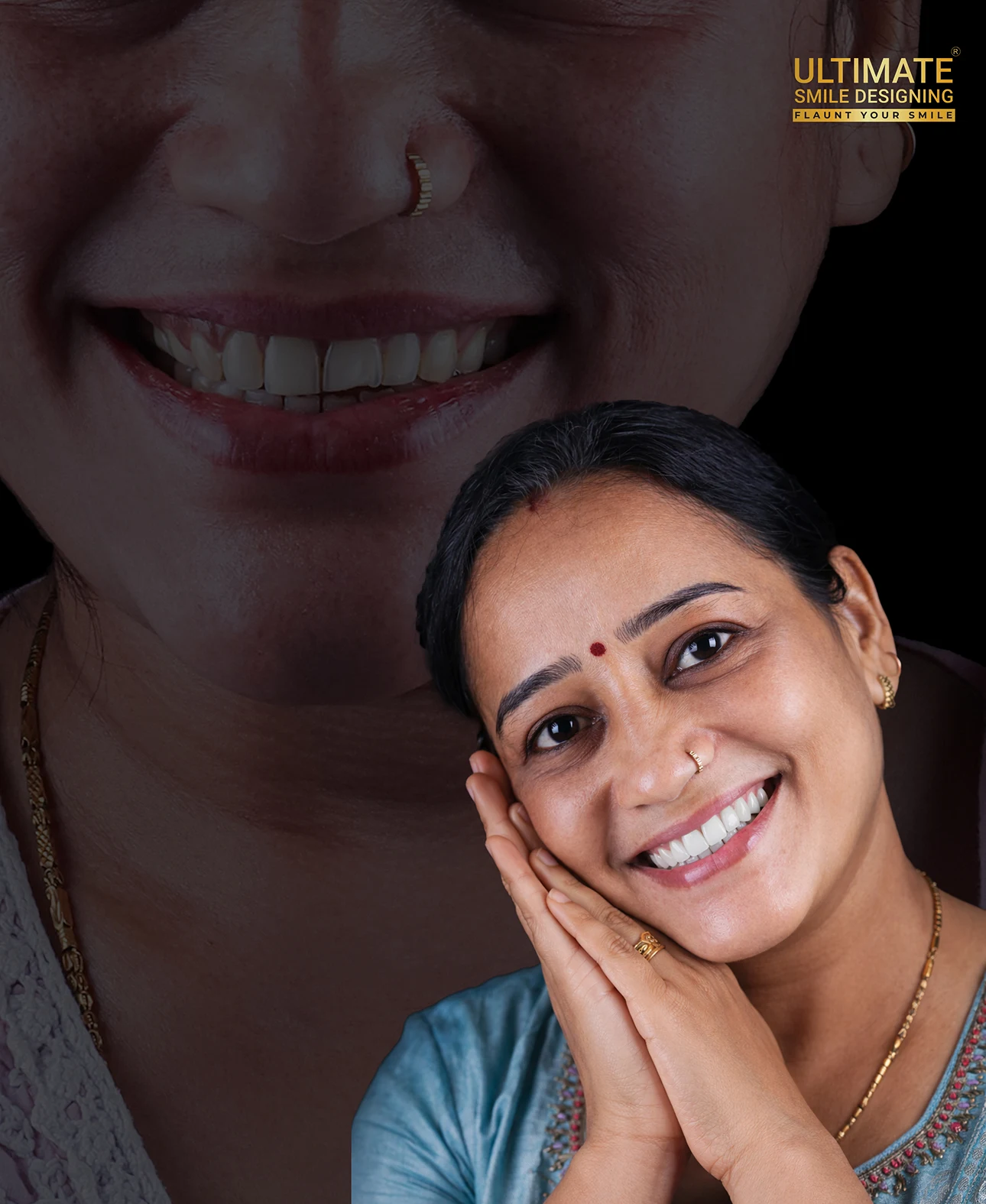 Professional smile design results before and after treatment