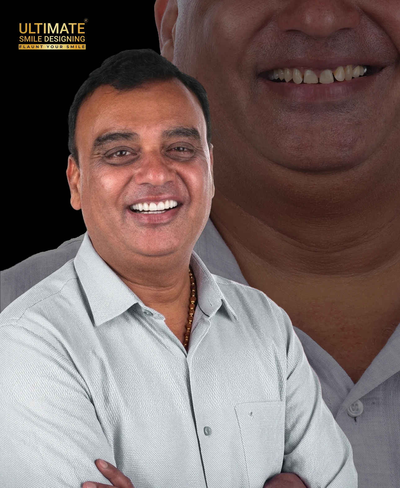 Dental makeover before after
