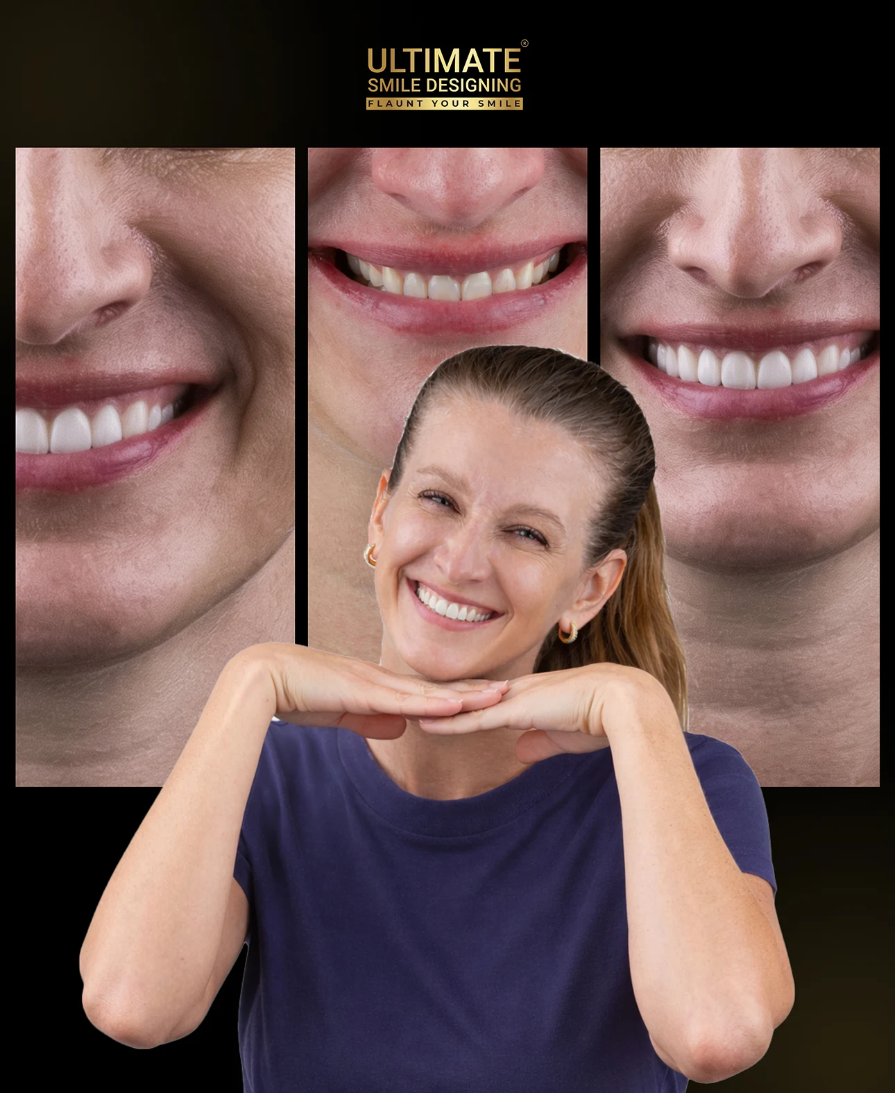 Luxury smile design transformation before and after results
