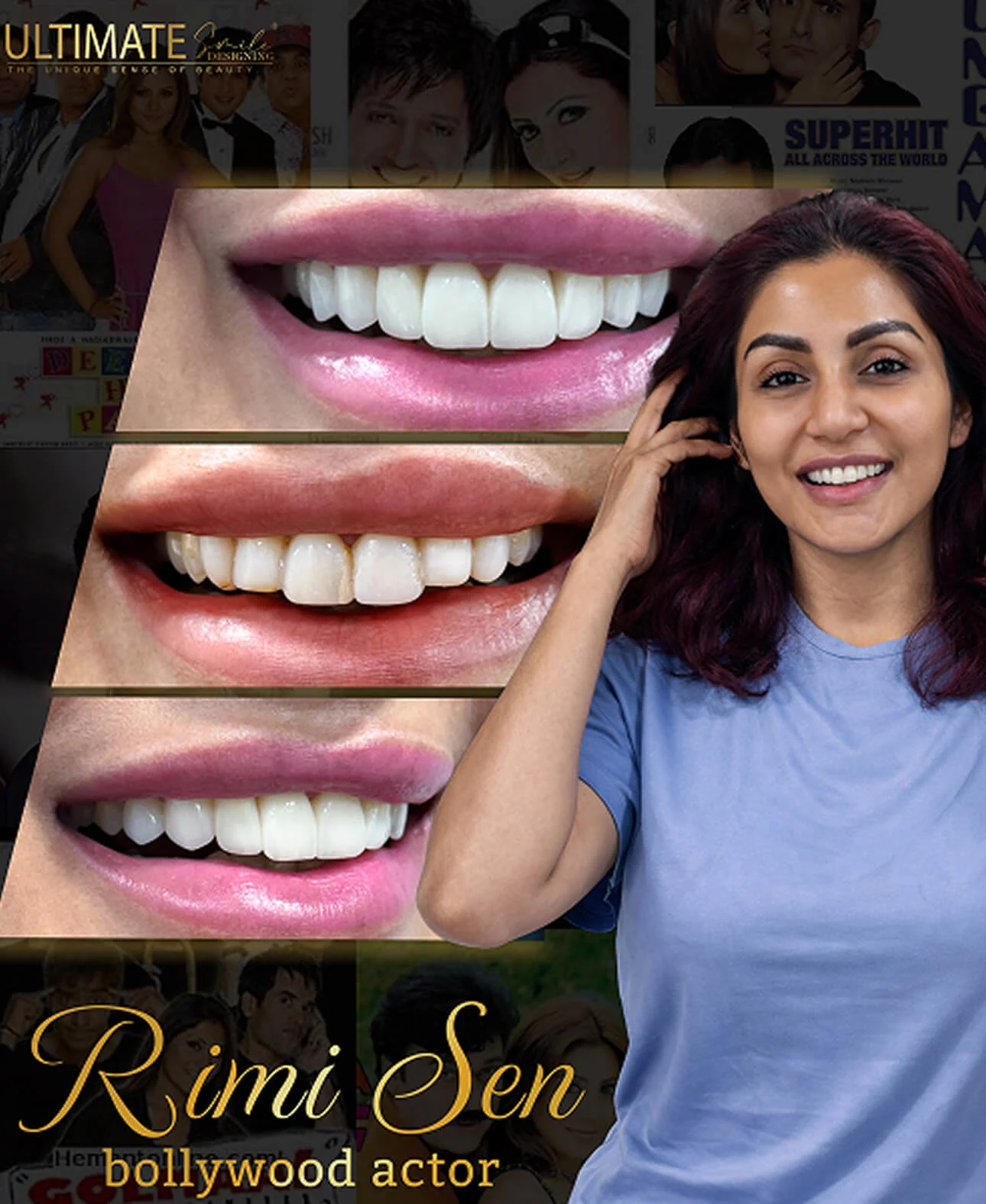 Patient smile transformation – digital smile design before and after