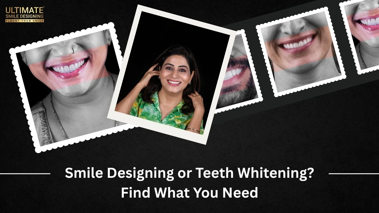 Smile Designing or Teeth Whitening? Find What You Need