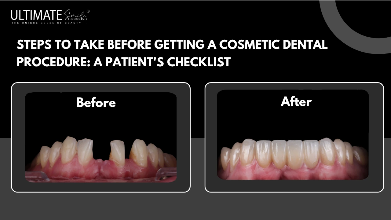 Steps to Take Before Getting a Cosmetic Dental Procedure: A Patient's Checklist