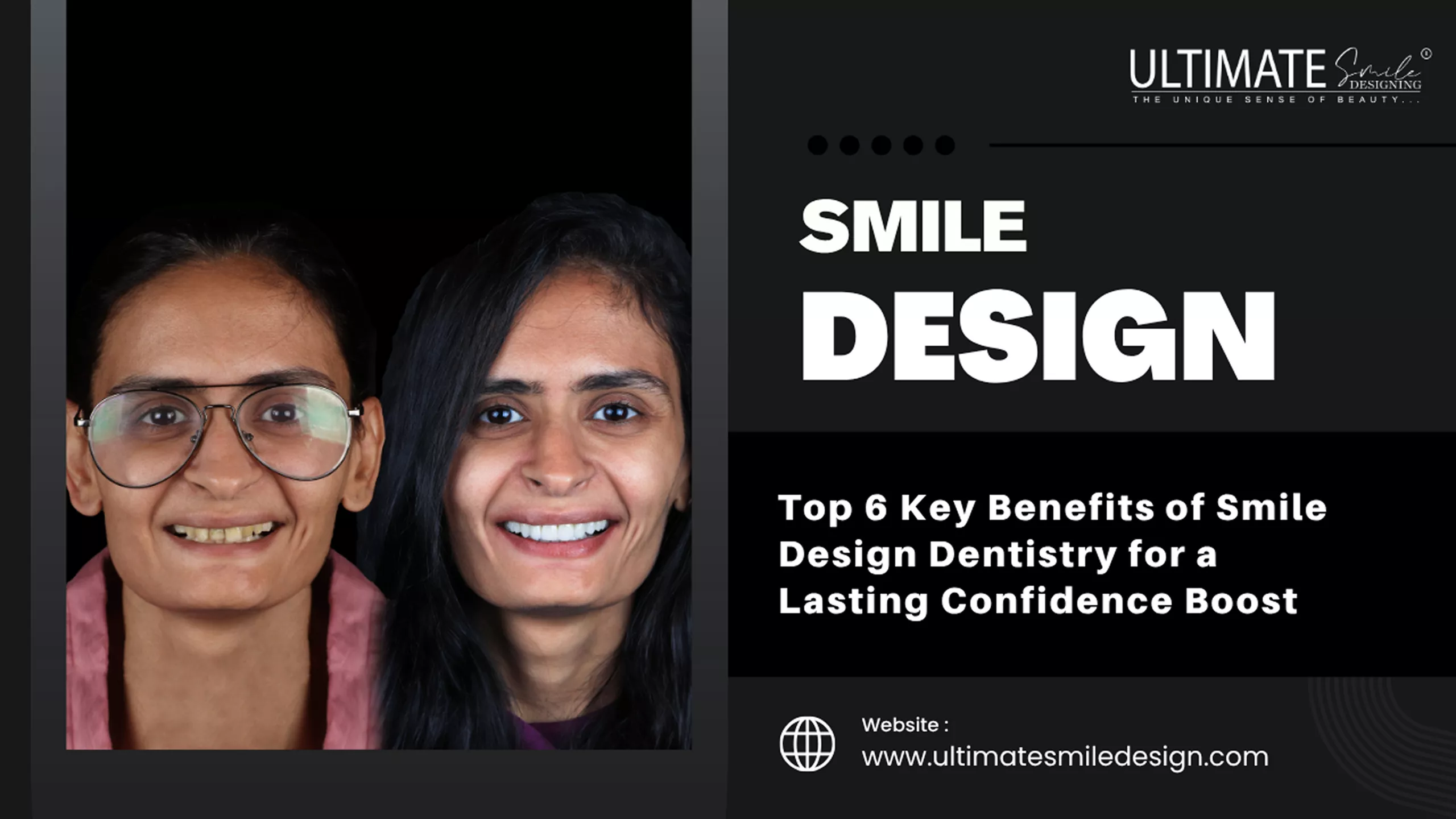 Top 6 Key Benefits of Smile Design Dentistry for a Lasting Confidence Boost