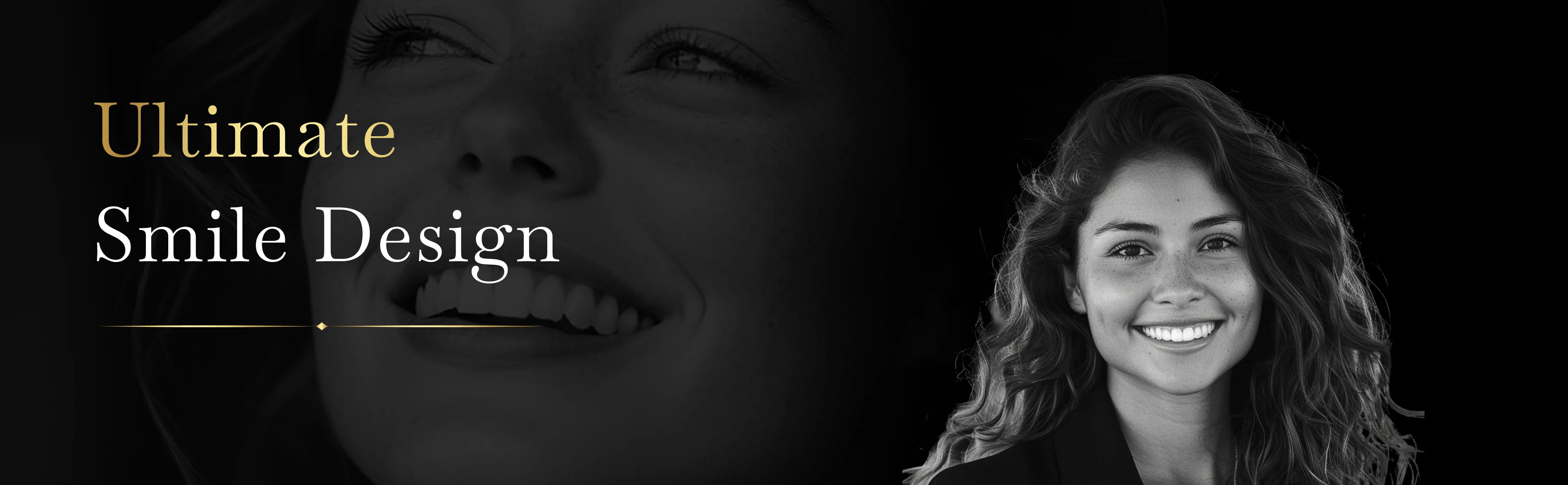 Ultimate Smile Design - 100% Money Back Guarantee