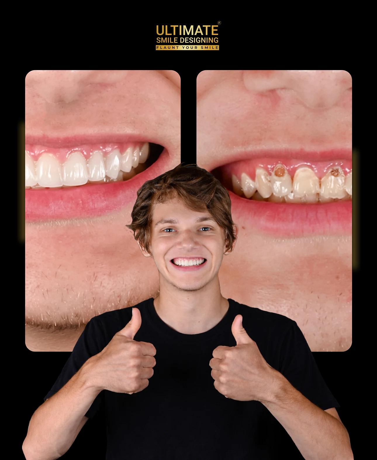 Clinical showcase highlighting artistic smile enhancement and real case outcomes