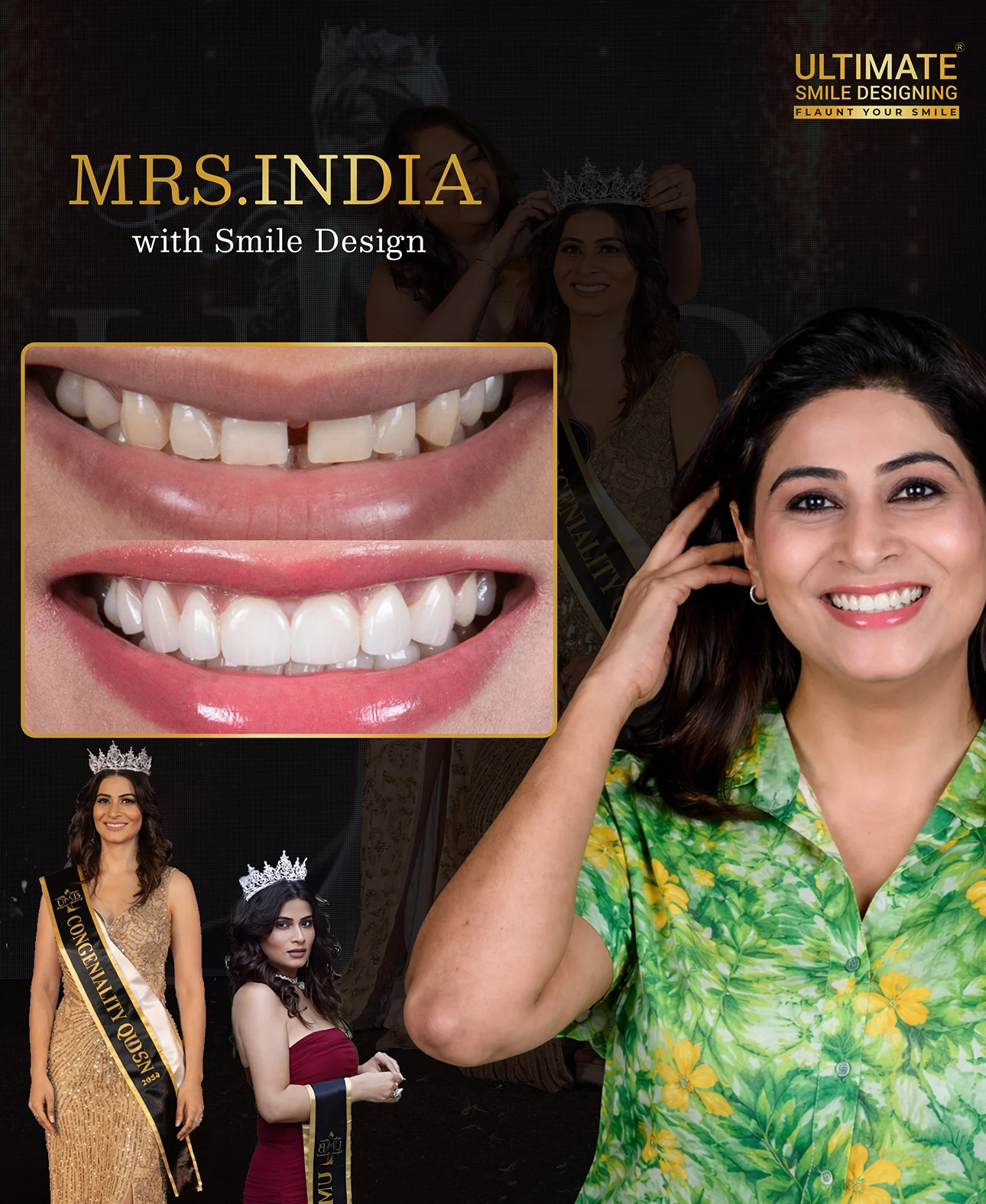 Visible dental improvements through advanced treatment shown in patient image timeline