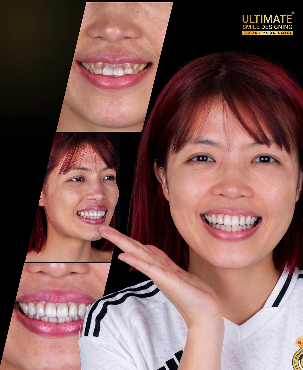 Image timeline of smile success stories from Ultimate Smile Design restorative care