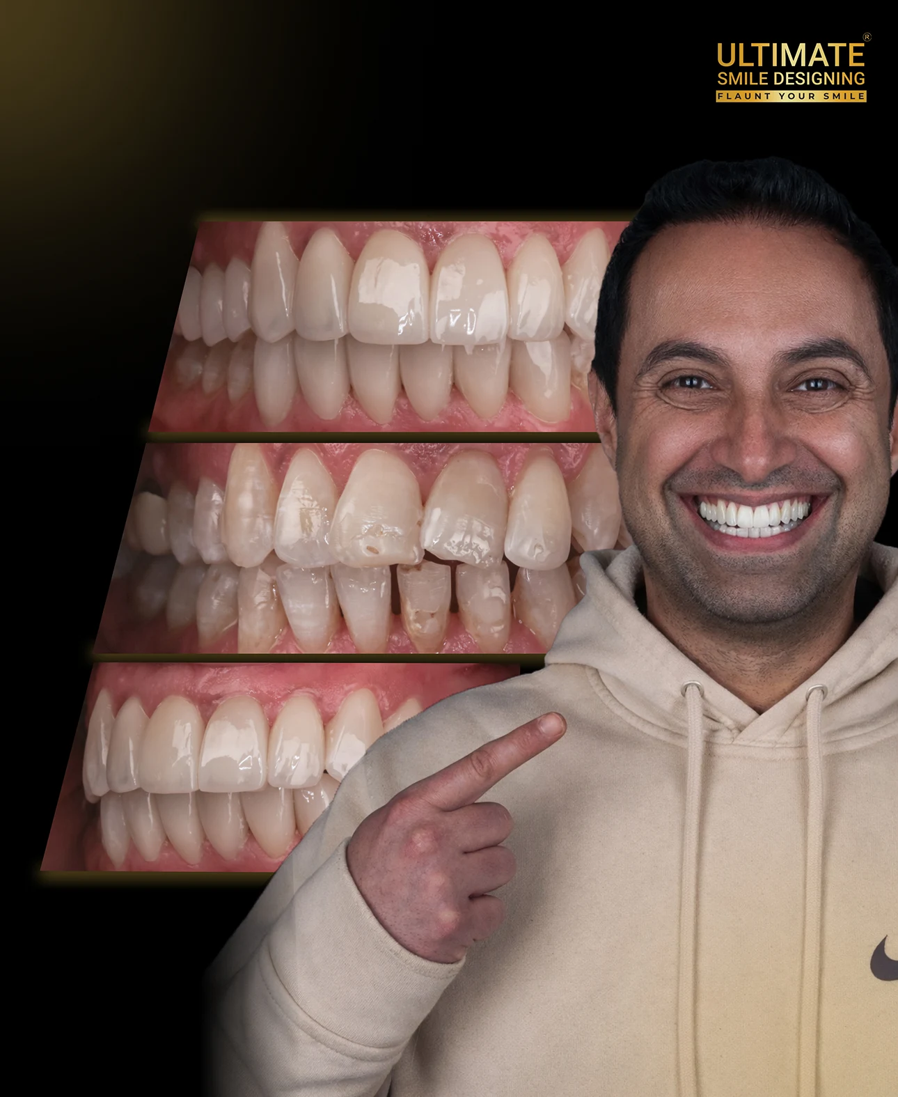 Gallery of restored smiles featuring aesthetic upgrades at Ultimate Smile Design center