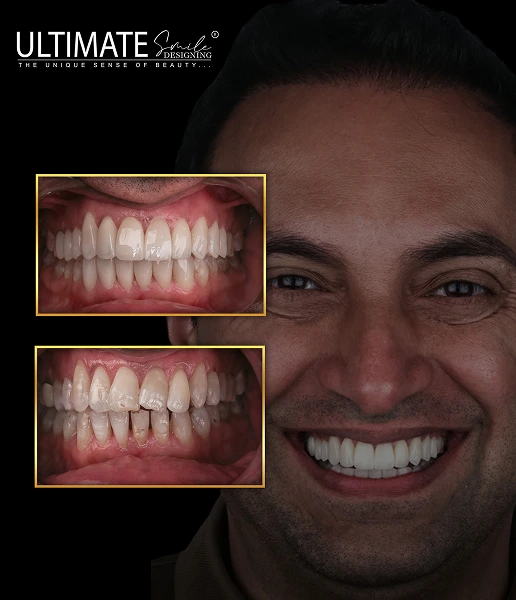 High-impact before-after visuals of confident smiles crafted by expert clinicians