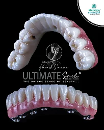 Ultimate Smile Design Service Final Result Image of Dental Prosthesis