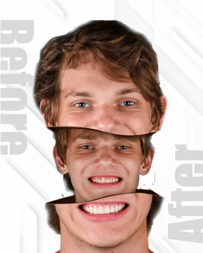 Stunning visual results from personalized smile design captured in patient gallery view