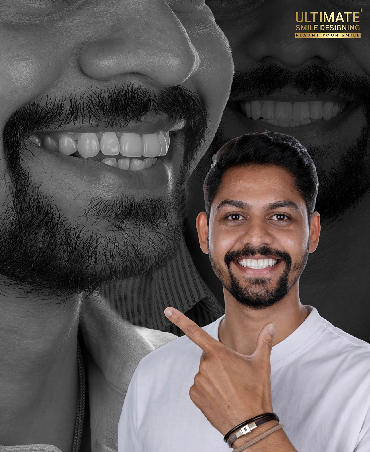 Premium smile design treatment Ultimate Smile Design before and after case study