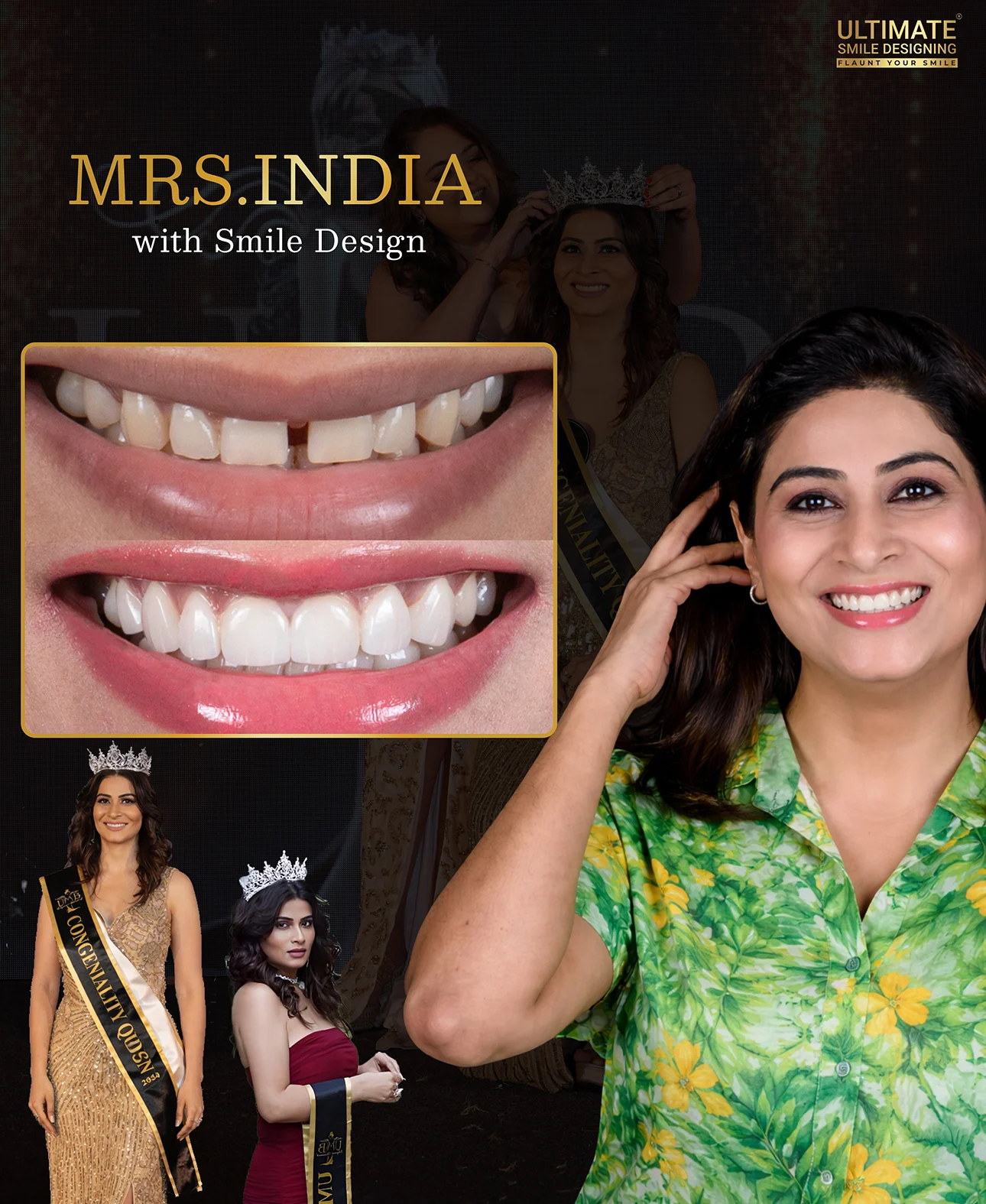 Before and after Ultimate Smile Design showing a confident and perfect smile correction