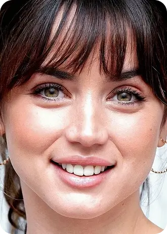 Girl showcasing radiant smile representing ideal results from expert Ultimate Smile Designers