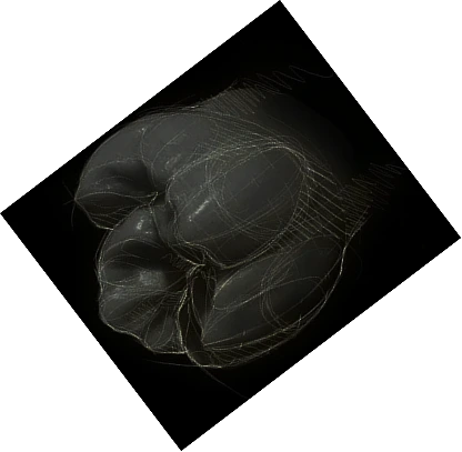 Image of Single Teeth with Digital Lines for Smile Designing